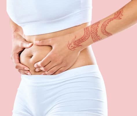 Who is a candidate for a mini tummy tuck