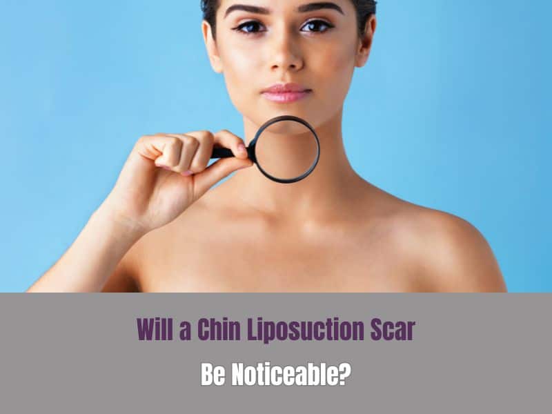 Will a Chin Liposuction Scar Be Noticeable