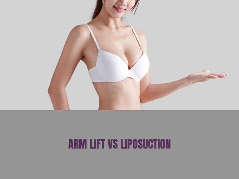 arm lift vs liposuction
