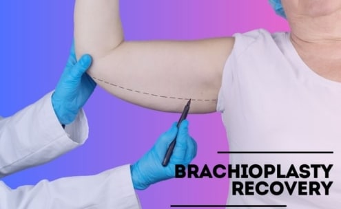 brachioplasty recovery day by day