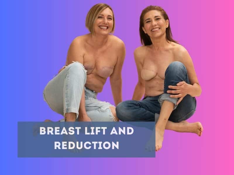breast lift and reduction