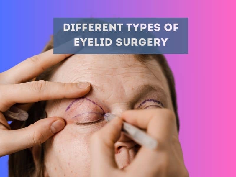 different types of eyelid surgery