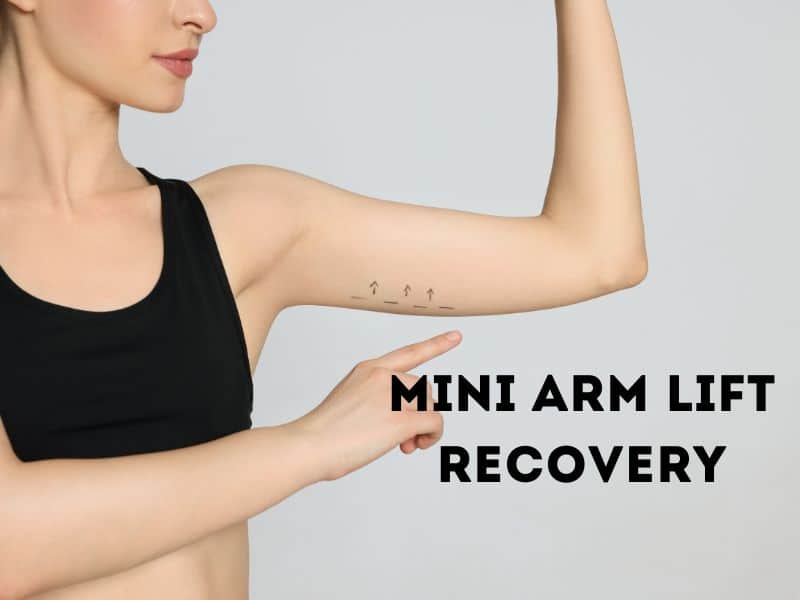 mini arm lift recovery